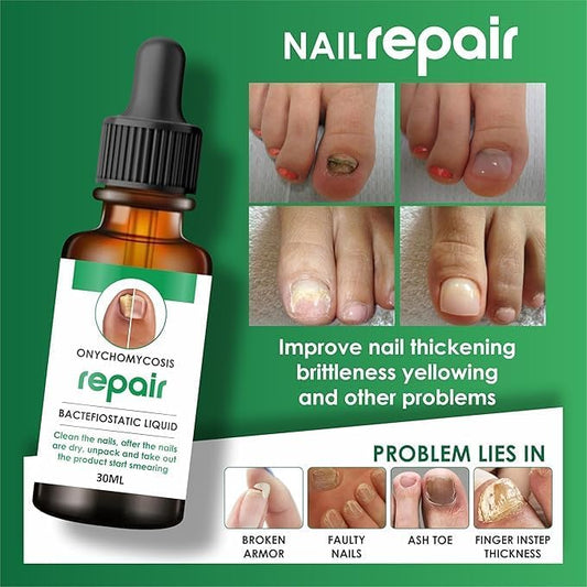 Ventroo™ Advanced Nail Repair Serum