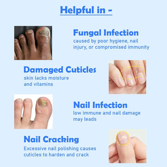 Ventroo™ Advanced Nail Repair Serum